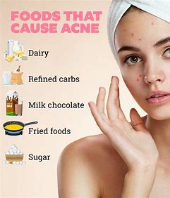 acne treatment with deit